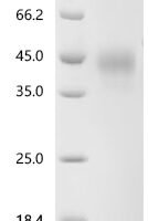 Mouse Tumor necrosis factor receptor superfamily member 16 (Ngfr), partial Recombinant Protein, C-10His - BioCrest Sci