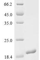 Human Neuronal vesicle trafficking-associated protein 1 (NSG1), partial Recombinant Protein - BioCrest Sci
