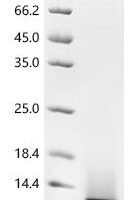 Epstein-Barr virus Protein BMRF2 (BMRF2), partial Recombinant Protein, C-His, aa 180–217, Yeast - BioCrest Sci