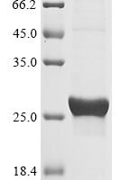 Human Interstitial collagenase (MMP1), partial Recombinant Protein, C-His - BioCrest Sci