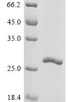 Chapare mammarenavirus Pre-glycoprotein polyprotein GP complex (GPC), partial Recombinant Protein - BioCrest Sci
