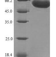 Human F-box/LRR-repeat protein 2 (FBXL2) Recombinant Protein, N-His-SUMO - BioCrest Sci