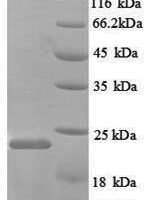 Rat Nitric oxide synthase, endothelial (Nos3), partial Recombinant Protein - BioCrest Sci