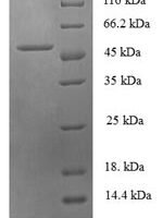 Human Checkpoint protein HUS1 (HUS1), partial Recombinant Protein - BioCrest Sci