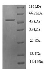 Human Checkpoint protein HUS1 (HUS1), partial Recombinant Protein, Homo sapiens (Human), E.coli, N-terminal 6xHis-SUMO-tagged, 47.6 kDa, purity >≥ 90% as determined by SDS-PAGE.