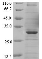 Human Major facilitator superfamily domain-containing protein 8 (MFSD8), partial Recombinant Protein - BioCrest Sci