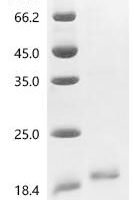 Fusarium oxysporum f. sp. lycopersici ribonuclease T1 Recombinant Protein - BioCrest Sci