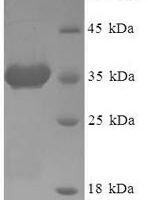 Human ADP-ribosylation factor 6 (ARF6) Recombinant Protein - BioCrest Sci