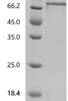 Human GDNF family receptor alpha-1 (GFRA1) Recombinant Protein - BioCrest Sci