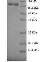 Human Fanconi anemia group C protein (FANCC) Recombinant Protein - BioCrest Sci