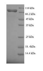 Human Fanconi anemia group C protein (FANCC) Recombinant Protein, Homo sapiens (Human), E.coli, N-terminal 6xHis-SUMO-tagged, 79.4 kDa, purity >≥ 90% as determined by SDS-PAGE.