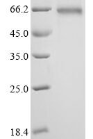 Human Heterogeneous nuclear ribonucleoproteins A2/B1 (HNRNPA2B1) Recombinant Protein, C-hFc1 - BioCrest Sci