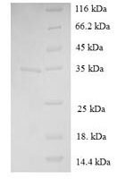 Human Immortalization up-regulated protein (IMUP) Recombinant Protein - BioCrest Sci