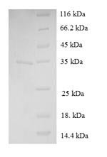 Human Immortalization up-regulated protein (IMUP) Recombinant Protein, Homo sapiens (Human), E.coli, N-terminal GST-tagged, 35.5 kDa, purity >≥ 90% as determined by SDS-PAGE.