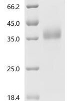 Human Ly-6/neurotoxin-like protein 1 (LYNX1) Recombinant Protein, N-His-SUMOstar, Isoform 2, Mature - BioCrest Sci