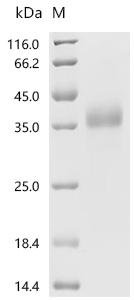 Human Ly-6/neurotoxin-like protein 1 (LYNX1) Recombinant Protein, N-His-SUMOstar, Isoform 2, Mature, Homo sapiens (Human), Yeast, N-terminal 6xHis-sumostar-tagged, 25.0 kDa, purity >≥ 95% as determined by SDS-PAGE.