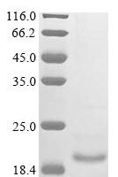 Mouse Alpha-2-macroglobulin receptor-associated protein (Lrpap1), partial Recombinant Protein, N-10His/C-Myc - BioCrest Sci