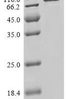 Human Tumor necrosis factor alpha-induced protein 2 (TNFAIP2) Recombinant Protein - BioCrest Sci
