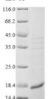 Mycobacterium tuberculosis Malate synthase G (glcB), partial Recombinant Protein - BioCrest Sci