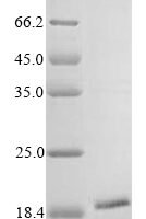 Human Putative teratocarcinoma-derived growth factor 3 (TDGF1P3) Recombinant Protein, C-His, aa 31–188, MW 18.8 kDa - BioCrest Sci