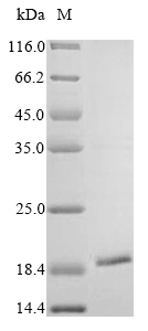 Human Putative teratocarcinoma-derived growth factor 3 (TDGF1P3) Recombinant Protein, C-His, aa 31–188, MW 18.8 kDa, Homo sapiens (Human), Baculovirus, C-terminal 6xHis-tagged, 18.8 kDa, purity >≥ 85% as determined by SDS-PAGE.