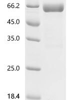 Human Placenta growth factor (PGF) Recombinant Protein, C-hFc1 - BioCrest Sci
