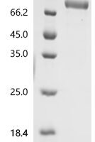 Mouse Interleukin-6 receptor subunit alpha (Il6ra), partial Recombinant Protein - BioCrest Sci