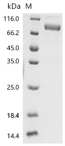 Mouse Interleukin-6 receptor subunit alpha (Il6ra), partial Recombinant Protein, Mus musculus (Mouse), Mammalian cell, C-terminal hFc1-tagged, 66.4 kDa, purity >≥ 95% as determined by SDS-PAGE.