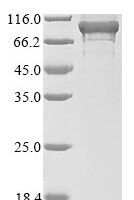 Human Adenylate kinase 7 (AK7) Recombinant Protein, N-10His/C-Myc - BioCrest Sci