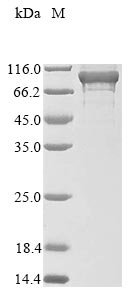 Human Adenylate kinase 7 (AK7) Recombinant Protein, N-10His/C-Myc, Homo sapiens (Human), E.coli, N-terminal 10xHis-tagged and C-terminal Myc-tagged, 90.1 kDa, purity >≥ 85% as determined by SDS-PAGE.