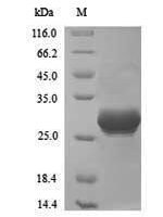 Vaccinia virus Complement control protein C3 (VACWR025) Recombinant Protein - BioCrest Sci