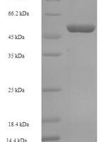 Human Oxidoreductase NAD-binding domain-containing protein 1 (OXNAD1) Recombinant Protein - BioCrest Sci