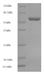 Human Oxidoreductase NAD-binding domain-containing protein 1 (OXNAD1) Recombinant Protein, Homo sapiens (Human), E.coli, N-terminal 6xHis-SUMO-tagged, 49.2 kDa, purity >≥ 90% as determined by SDS-PAGE.