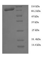 Human Calpain-1 catalytic subunit (CAPN1) Recombinant Protein - BioCrest Sci
