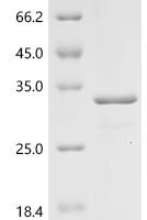 Bovine Interleukin-8 (CXCL8) Recombinant Protein - BioCrest Sci