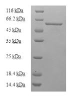 Mouse Uncharacterized aarF domain-containing protein kinase 2 (Adck2), partial Recombinant Protein, N-His-SUMO, Mus musculus (Mouse), E.coli, N-terminal 6xHis-SUMO-tagged, 61.4 kDa, purity >≥ 90% as determined by SDS-PAGE.