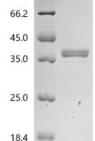 Human Arginase-1(ARG1) Recombinant Protein - BioCrest Sci