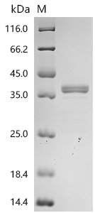 Human Arginase-1(ARG1) Recombinant Protein, Homo sapiens (Human), Yeast, N-terminal 6xHis-tagged, 36.8 kDa, purity >≥ 85% as determined by SDS-PAGE.