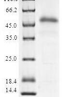 Human Suppressor of cytokine signaling 2 (SOCS2) Recombinant Protein - BioCrest Sci