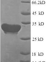 Human Cytochrome c oxidase subunit 4 isoform 1, mitochondrial (COX4I1) Recombinant Protein - BioCrest Sci