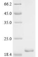 Mycobacterium tuberculosis variant africanum PE family protein PE13 (PE13) Recombinant Protein - BioCrest Sci