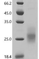 Human Leukocyte antigen CD37 (CD37), partial Recombinant Protein - BioCrest Sci