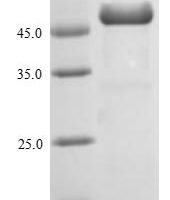 Staphylococcus aureus Enterotoxin type B (entB) Recombinant Protein, N-GST - BioCrest Sci