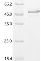 Human Syncytin-1 (ERVW-1), partial Recombinant Protein, C-His - BioCrest Sci