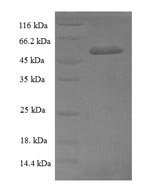 Human Thioredoxin-like protein 1 (TXNL1) Recombinant Protein, N-His-SUMO - BioCrest Sci