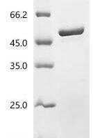 Escherichia coli O6:H1 Isocitrate lyase (aceA) Recombinant Protein - BioCrest Sci