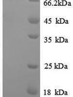 Escherichia coli Inducible ornithine decarboxylase (speF) Recombinant Protein - BioCrest Sci