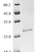 Human Origin recognition complex subunit 1 (ORC1), partial Recombinant Protein, C-10His, aa 1–200 - BioCrest Sci