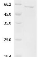 Human Large ribosomal subunit protein bL28m (MRPL28) Recombinant Protein - BioCrest Sci