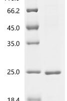 Mouse Granulocyte-macrophage colony-stimulating factor (Csf2) Recombinant Protein, C-His - BioCrest Sci